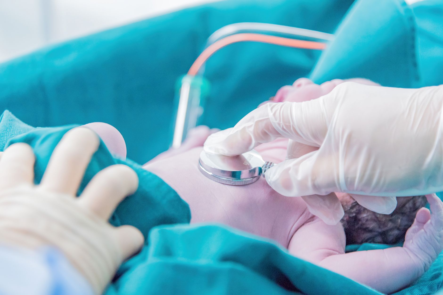 bronquiolite sintomas e tratamento